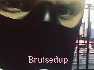 Bruisedup